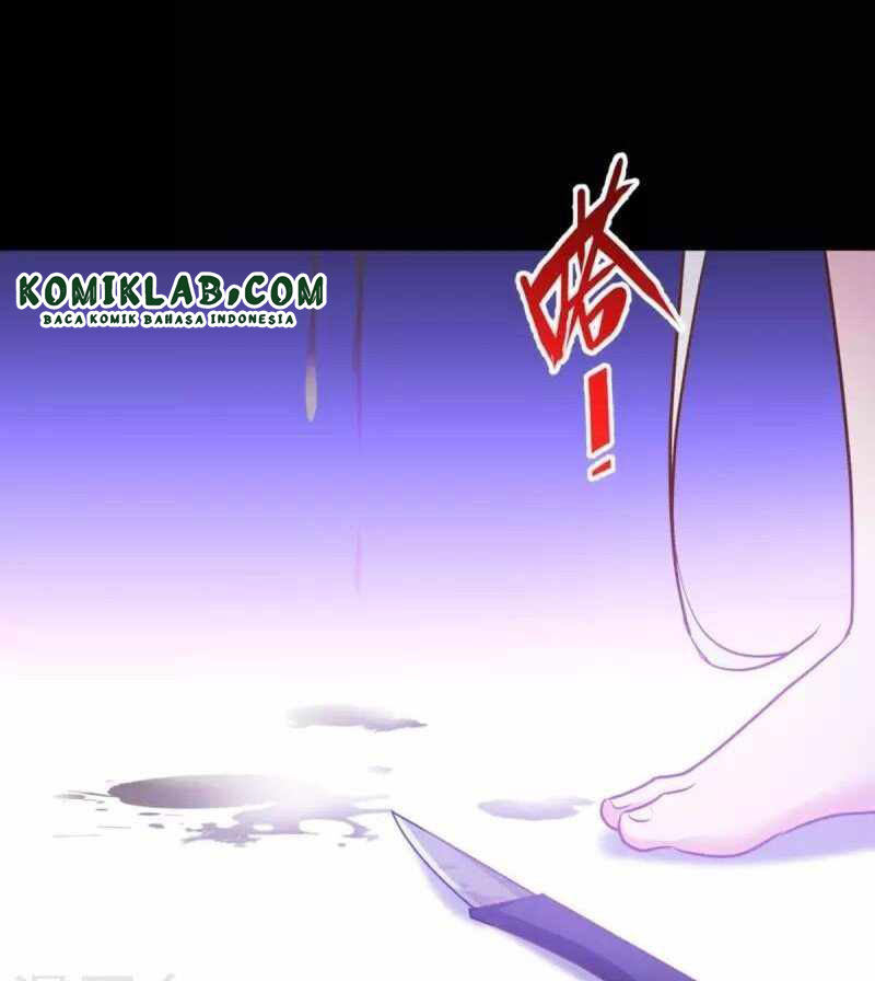 Became King After Being Bitten Chapter 24 Gambar 39